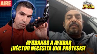 Héctor M. sufrió la amputación de su pierna y requiere una prótesis  ¡Ayúdanos a Ayudar con Piolin!
