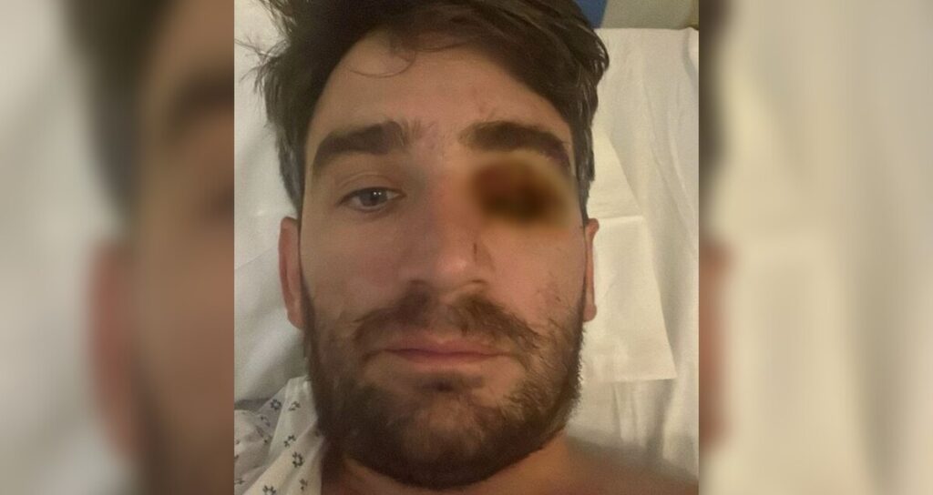 Hombre pierde el ojo por explosión pirotécnica en fiesta de Año Nuevo