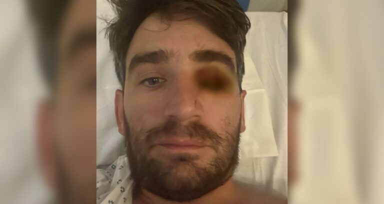 Hombre pierde el ojo por explosión pirotécnica en fiesta de Año Nuevo