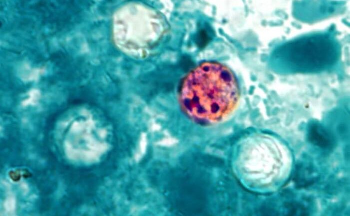 México confirma tres casos de ciclosporiasis, pero descarta por ahora que el brote en EE.UU. haya surgido en el país