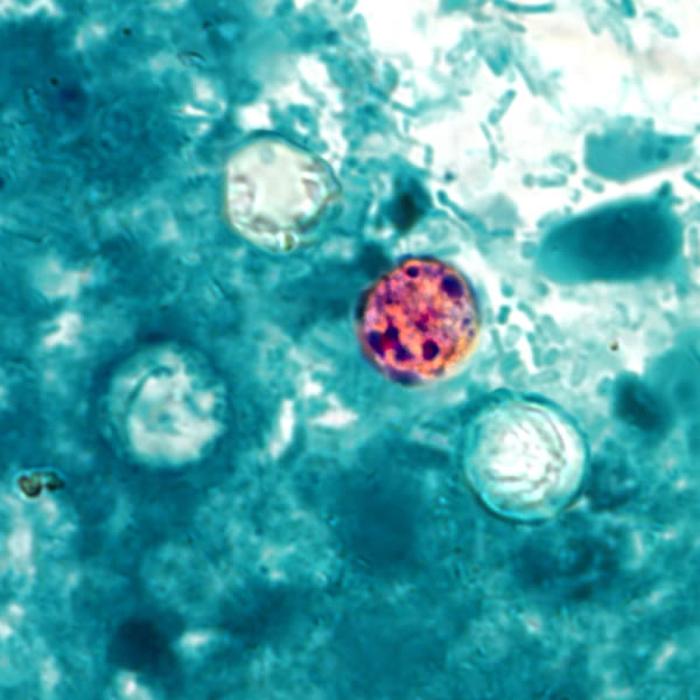 México confirma tres casos de ciclosporiasis, pero descarta por ahora que el brote en EE.UU. haya surgido en el país