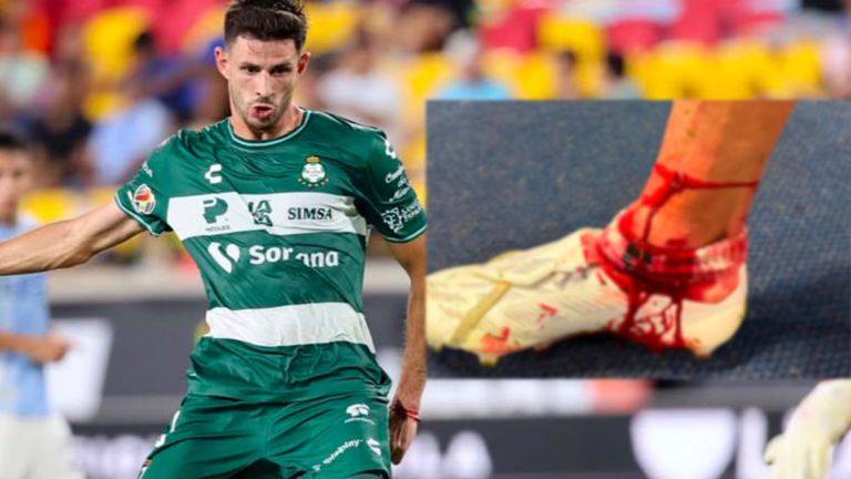 Santos Laguna exigirá respuesta a Concacaf por lesión de Lucas Di Yorio en la Leagues Cup