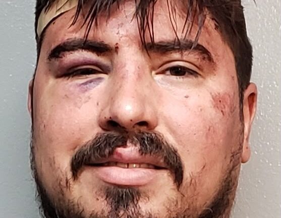 Sospechoso recibe fianza de $200 mil tras apuñalamiento en Brownsville